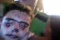 Robo po troch dnoch opat opity