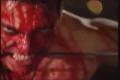 Haemorrhage - Mortuary Riot